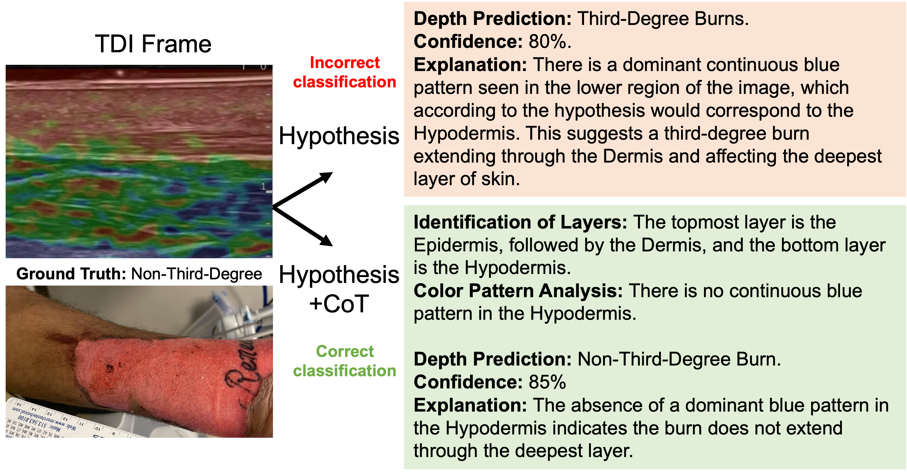 mhsrs_2025_sample_cot.png